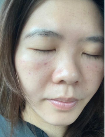 修秘水光Day1自然光膚況紀錄